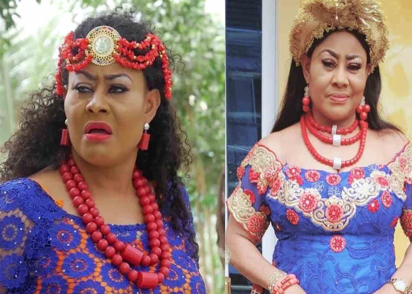 Popular Nollywood Actress, Ngozi Nwosu, On Hospital Bed, Appeals for ₦30m Financial Help